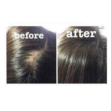 [HANDMADE] TINH DẦU BƯỞI - Mọc tóc nhanh - giảm rụng tóc, phục hồi tóc hư tổn - Không hóa chất - ảnh thật khách feedback