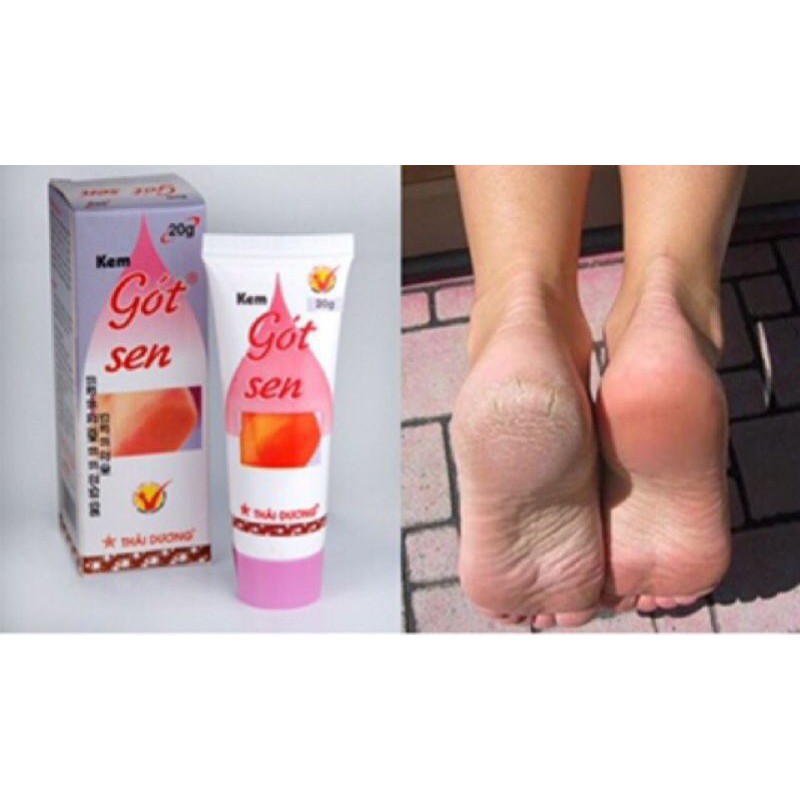 Gót sen làm mềm gót chân