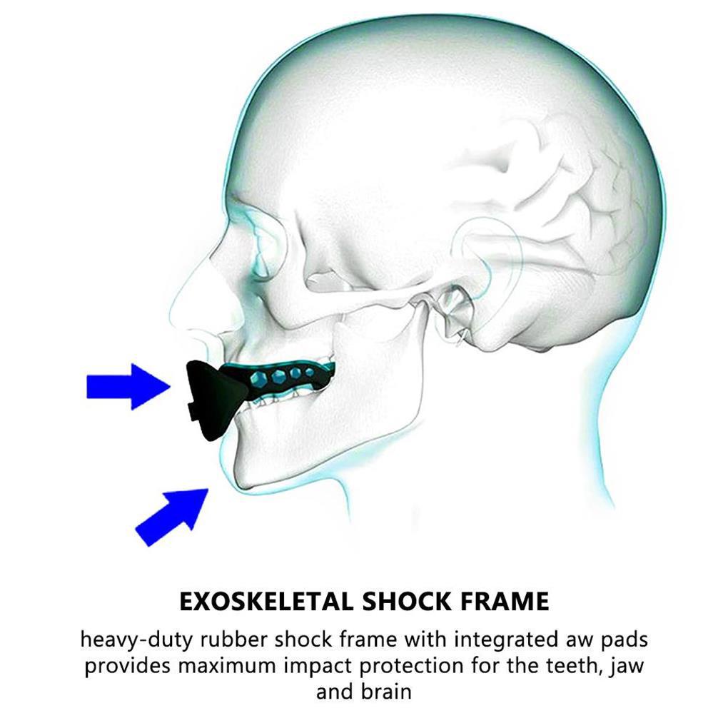 Bộ 2 Đai Bảo Vệ Răng Chống Nước Chống Cắn Khi Chơi Bóng Rổ / Bóng Đá