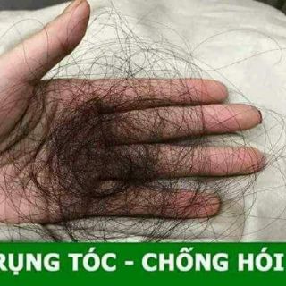 TINH DẦU XỊT BƯỞI MỌC TÓC