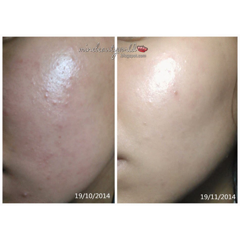 Paula's Choice Skin Perfecting 2% BHA Liquid Dung Dịch Giảm Mụn Ẩn, Loại Bỏ Tế Bào Chết 118ml - Cila House
