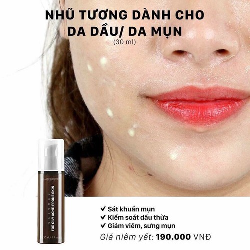 Nhũ tương giảm mụn, kháng khuẩn, kiềm dầu Narguerite (30ML) - DATE 2024