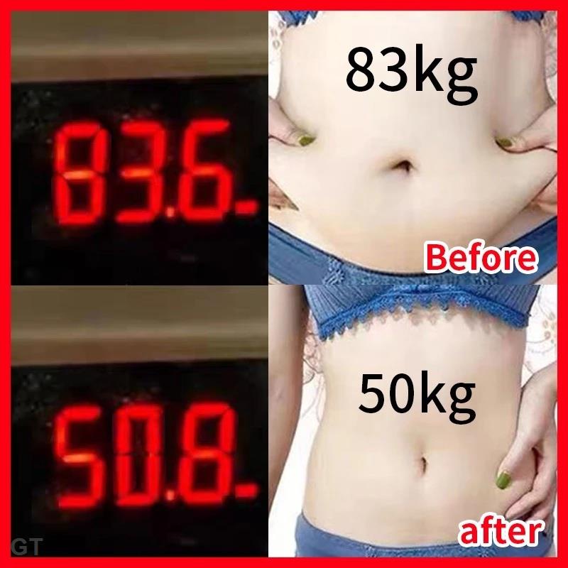 Hộp 60 Miếng Dán Đốt Cháy Mỡ Thừa