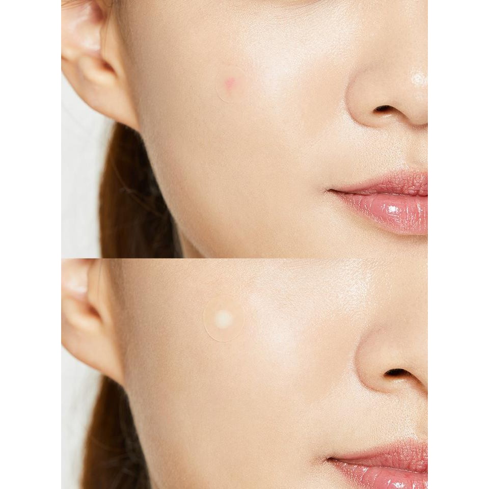Combo Gel Rửa Mặt + Dán Mụn COSRX: Low pH Good Morning  150ml + Acne Pimple Master Patch 24 miếng