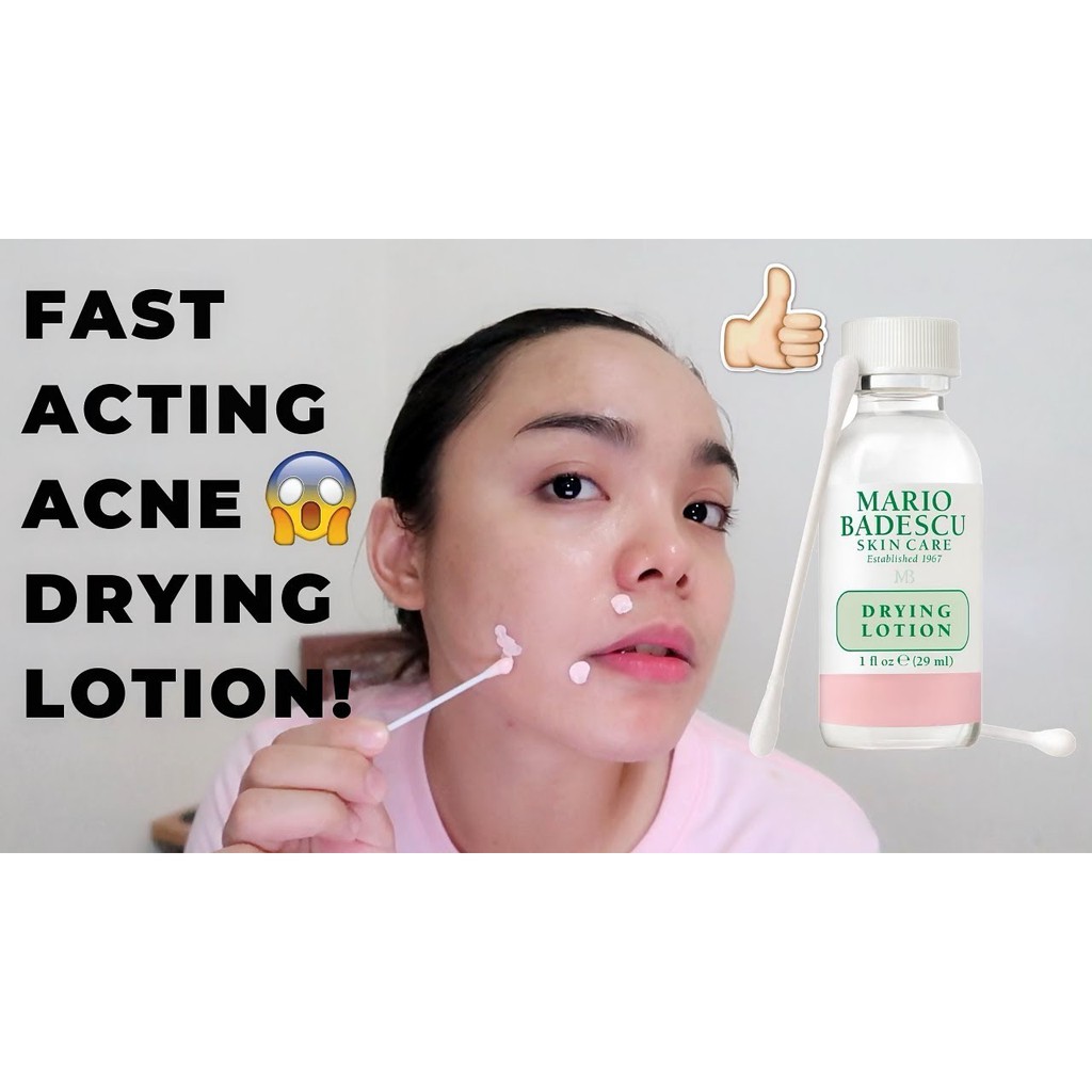 Dung Dịch Chấm Mụn Mario Badescu Drying Lotion Làm Khô Cồi và TIêu Mụn, Giảm Sưng Tấy 29ml - MnB Store