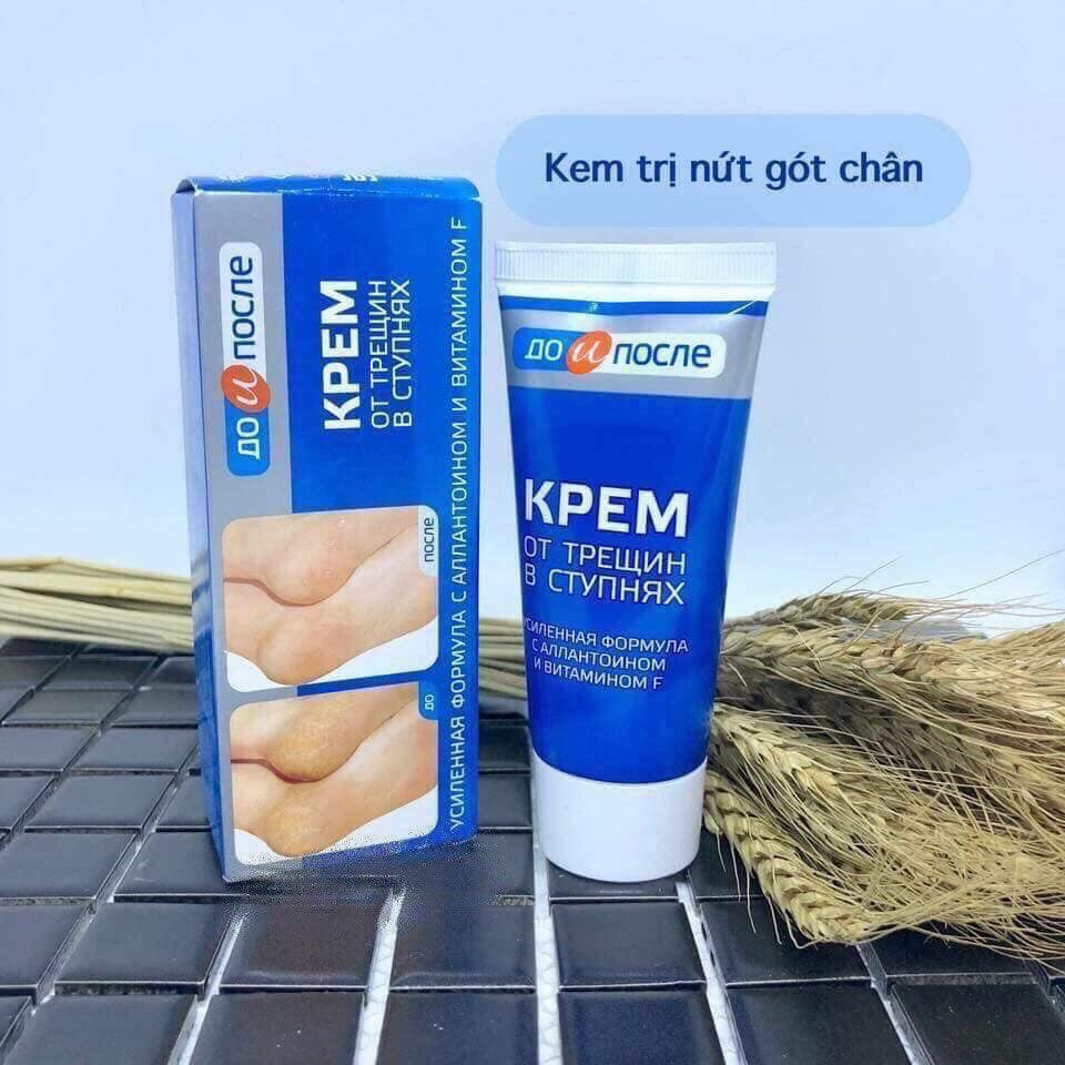 KEM TRỊ NỨT GÓT CHÂN