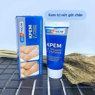 Kem trị nứt gót chân