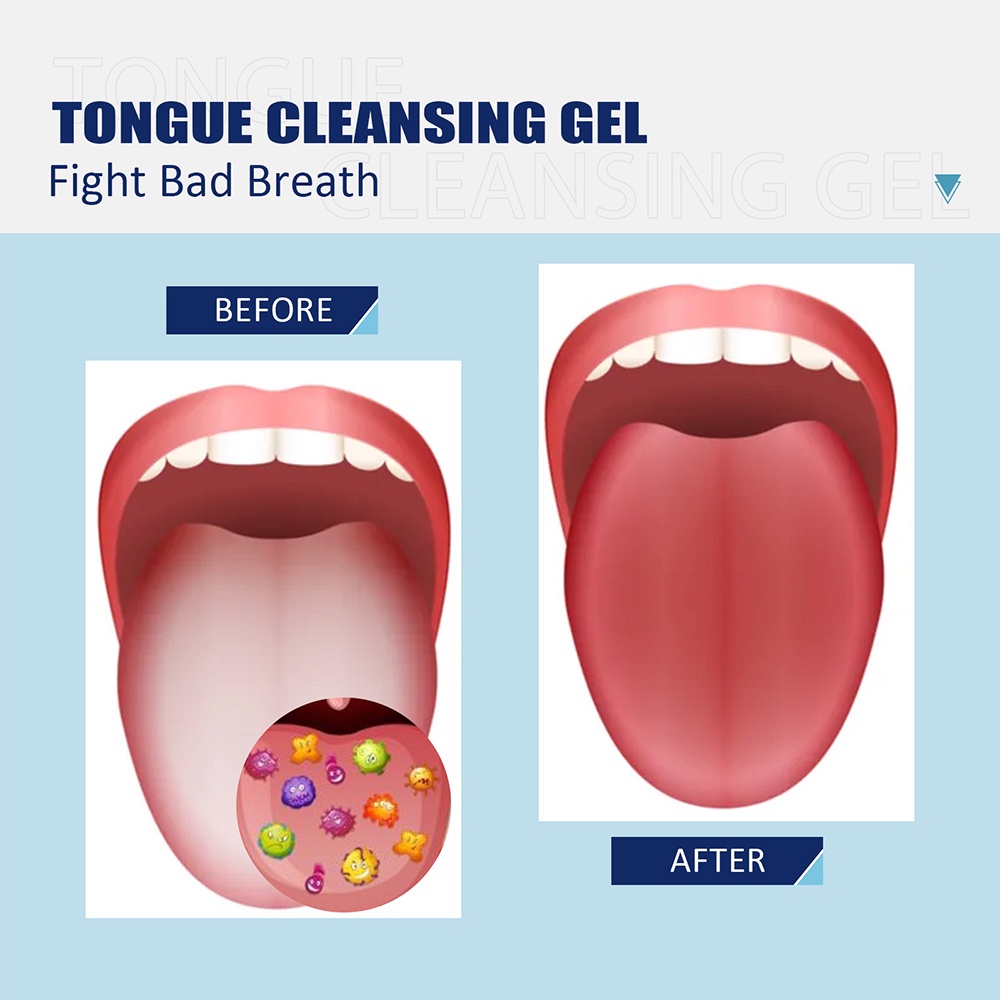 Bộ Gel Và Dụng Cụ Làm Sạch Lưỡi Eelhoe Làm Sạch Lỗ Chân Lông Giữ Làm Sạch Không Khí, Cây cạo lưỡi, vệ sinh lưỡi  bằng nhựa,Dụng cụ cạo lưỡi ,Bộ Gel Làm Sạch Lưỡi 50g Kèm Cọ Silicone Làm Sạch Lưỡi