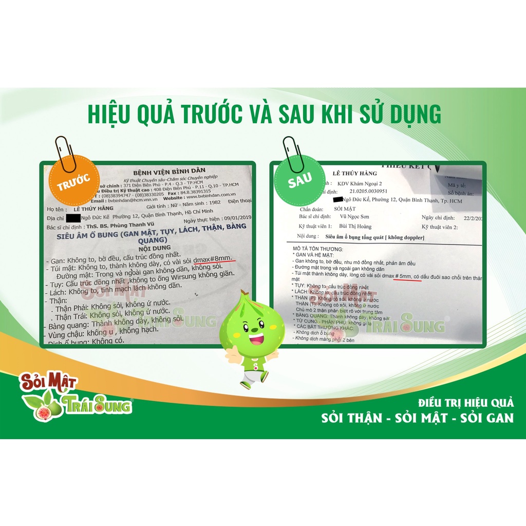 SẢN PHẨM HỖ TRỢ CẢI THIỆN SỎI MẬT - SỎI MẬT TRÁI SUNG