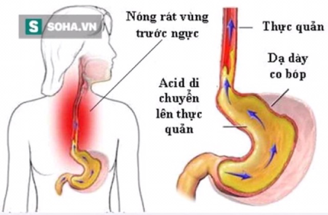 Viên Uống Dạ Dày Kwangdong Hàn Quốc, Hộp 200 Viên Nén | BigBuy360 - bigbuy360.vn