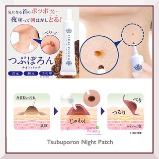 KEM MỜ NỐT RUỒI TSUBUPORON NIGHT PATCH