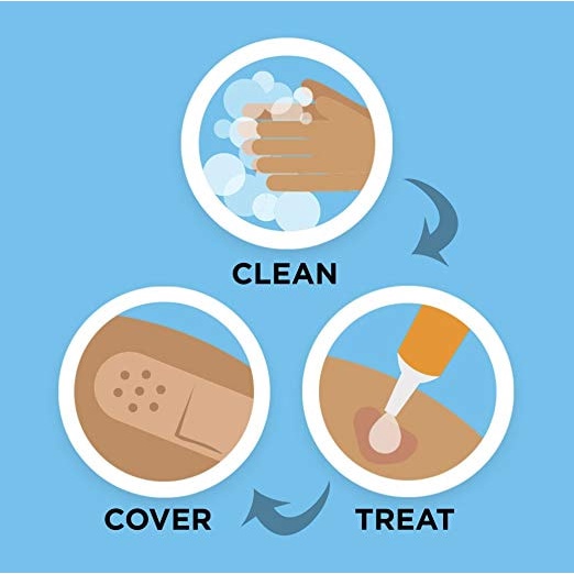 Neosporin kem mỡ đa năng bôi vết thương