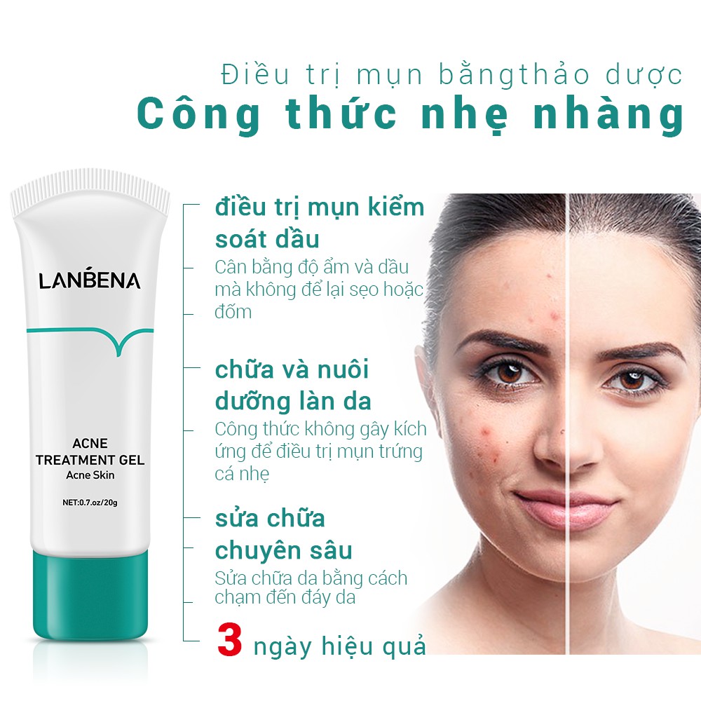 Kem hỗ trợ cải thiên tình trạng mụn LANBENA hiệu quả tức thì dung tích 20g