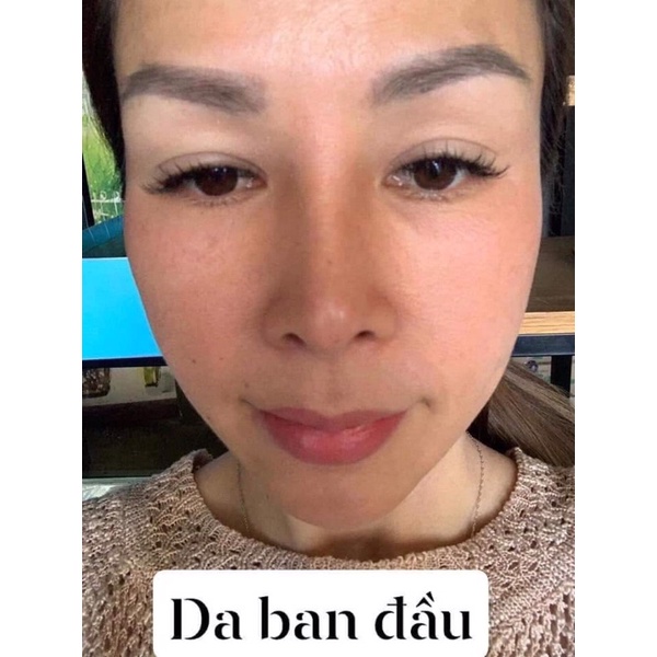 5 HỘP KEM CHAMOMILESKILL