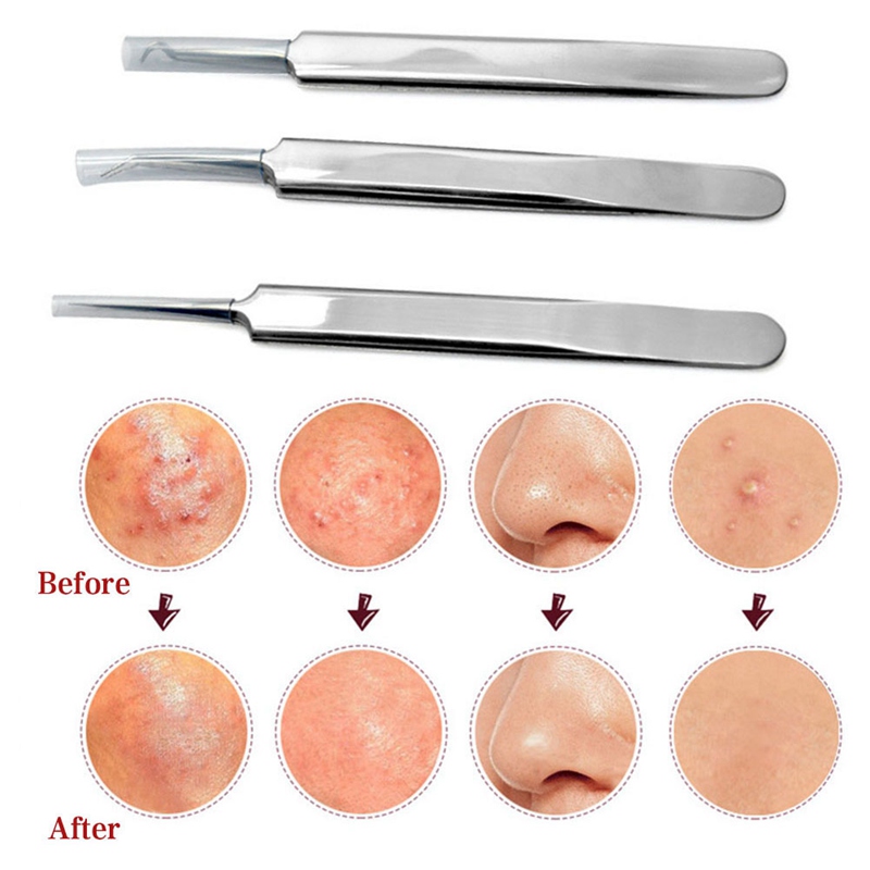 (Hàng Mới Về) 1 Nhíp Kẹp 3 Thiết Kế Hỗ Trợ Chăm Sóc Móng Tay / Mặt / Mặt / Mụn Trứng Cá Nhân213 | BigBuy360 - bigbuy360.vn