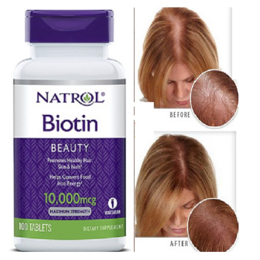 [ CHÍNH HÃNG ] Viên uống mọc tóc, chống rụng tóc NATROL BIOTIN