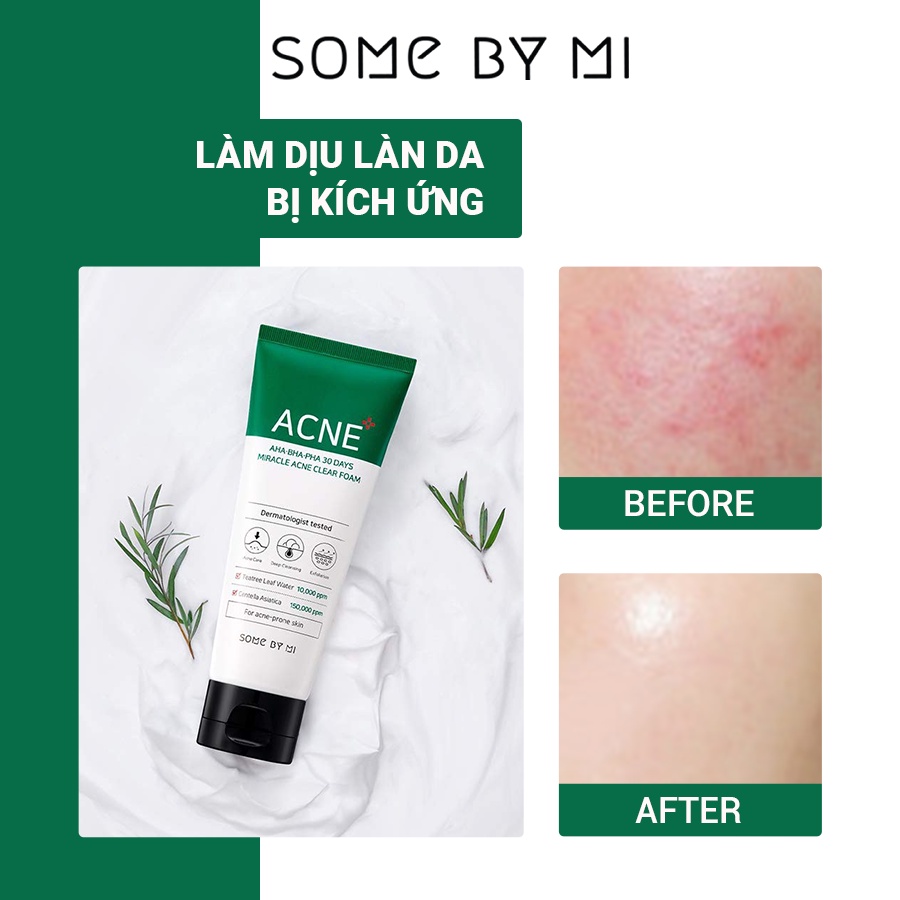 Sữa Rửa Mặt Some By Mi AHA.BHA.PHA 30 Days Miracle Cleansing Foam 100ml