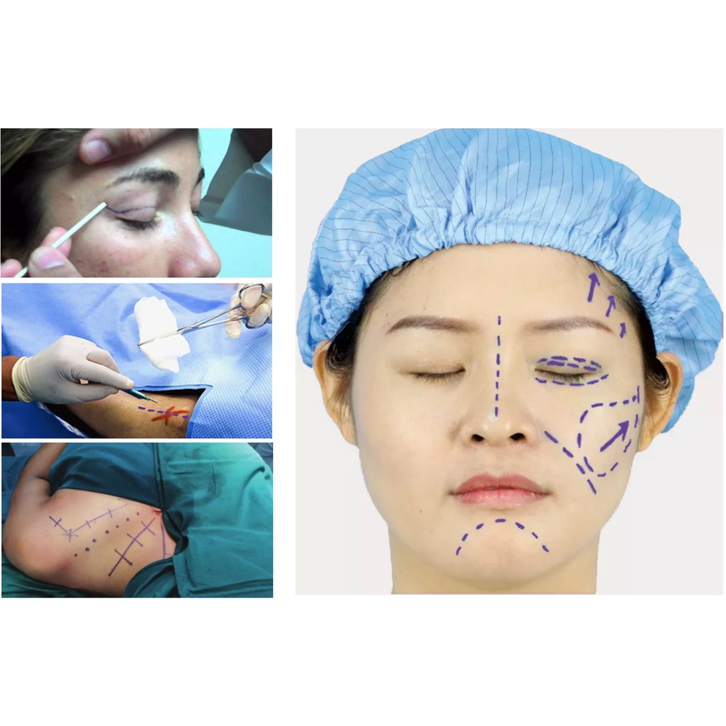 Sterile Pen- Bút kèm thước vô trùng đánh dấu vết mổ phẫu thuật thẩm mỹ không trôi- Bút tiệt trùng phun xăm tattoo