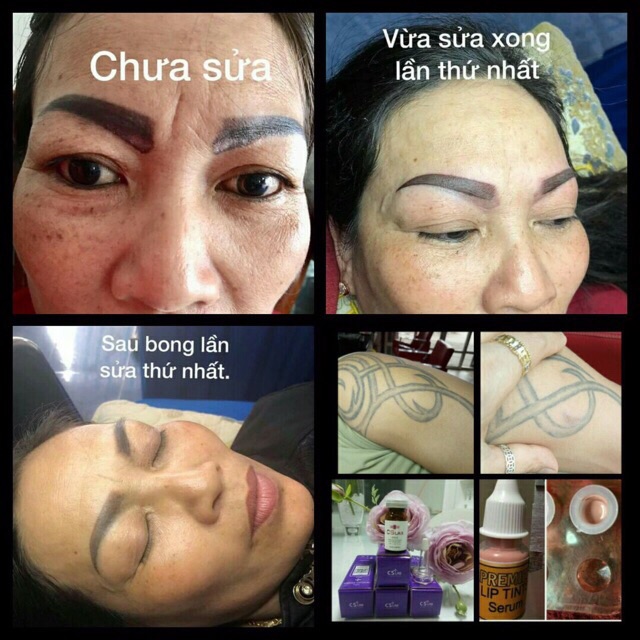 Dung dịch CSLAB xoá hình xăm lâu năm.