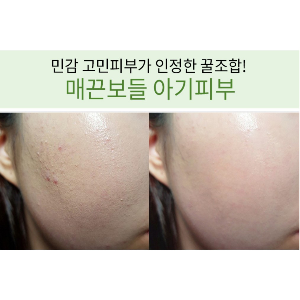 Tinh chất rau má DR.AG+ Cica hyaluronic calming Ampule