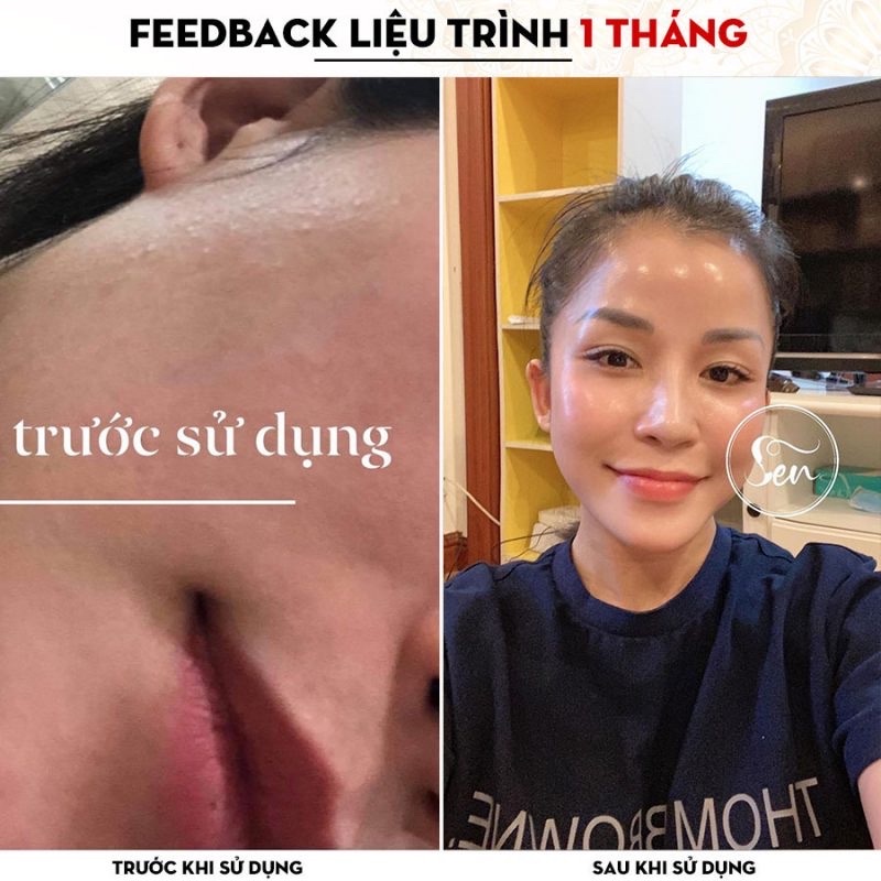 Tinh Chất Dưỡng Tái Tạo Da Dược Phẩm Sen - 30ML | BigBuy360 - bigbuy360.vn
