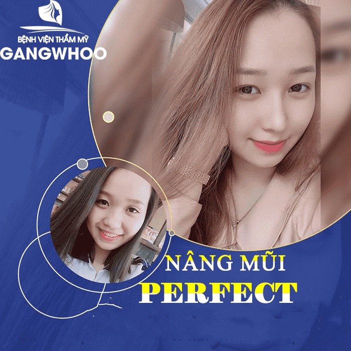 Dịch vụ nâng mũi Perfect tại Gangwhoo