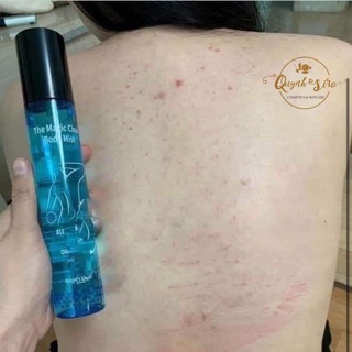 XỊT MỤN LƯNG THE MAGIC CLEAR BODY MIST