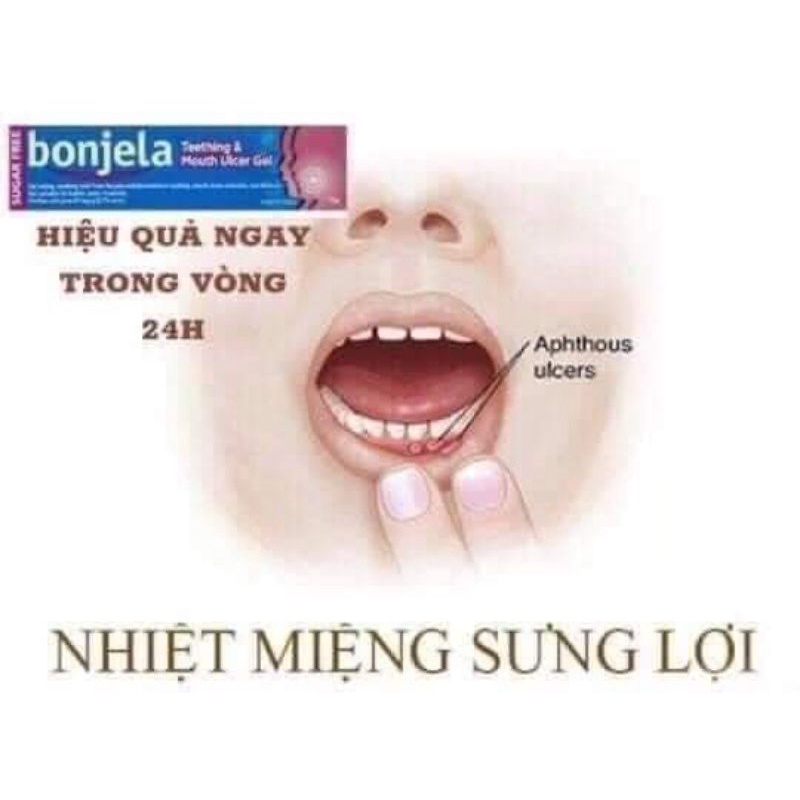 Kem bôi nhiệt miệng, giảm sưng lợi cho bé mọc răng Bonjela  Gel 15g