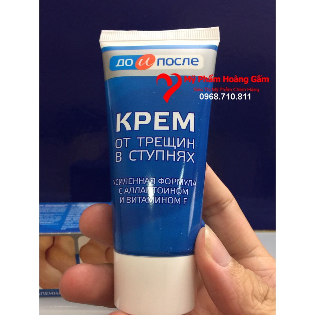 Kem Nứt Gót Chân Nga Kpem Apteka Nga 50ml