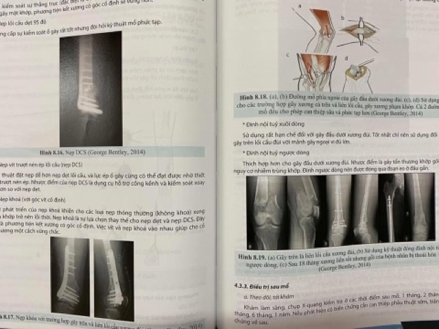 Sách - Chẩn đoán và điều trị gãy xương trật khớp chi dưới ( Giáo trình đào tạo sau đại học)