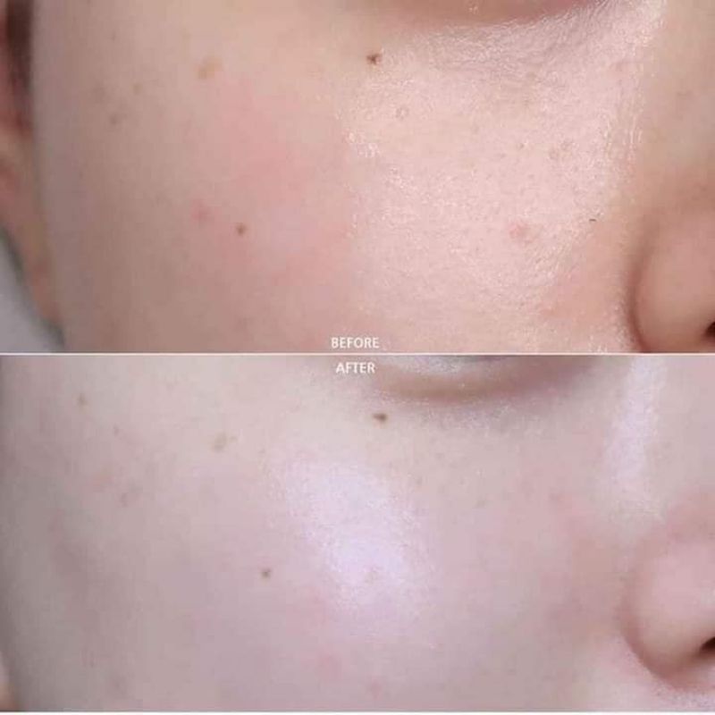 [Mỹ] Kem dưỡng da  cấp độ ẩm, sáng da Kehl's Dermatologist Soloutions 50ml