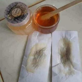 COMBO WAX VEO MỠ TRĂN