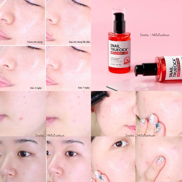 Tinh Chất Dưỡng Phục Hồi, Cải Thiện Vết Thâm, Sẹo, Làm Dịu Da Some By Mi Snail Truecica Miracle Repair Serum