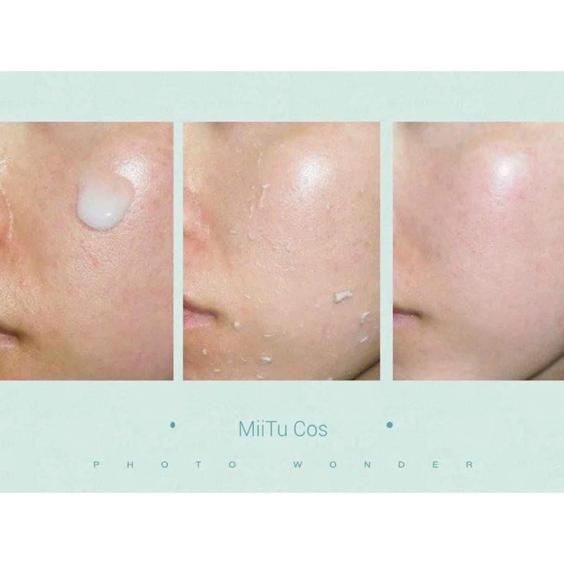 Tẩy tế bào chết Miitu Cos - Gel tẩy tế bào chết sáng da