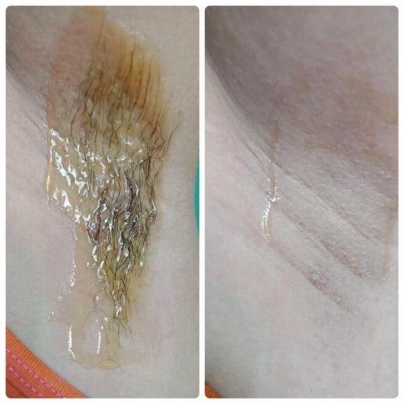 Wax lông An Lành an toàn cho da sạch lông chỉ sau 30 giây giúp vùng cánh trắng sáng mịn màng | BigBuy360 - bigbuy360.vn