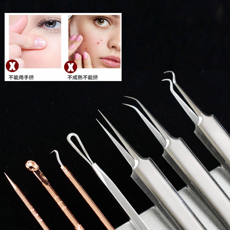 Bộ dụng cụ nặn mụn đầu đen chuyên dụng có túi đựng tiện lợi