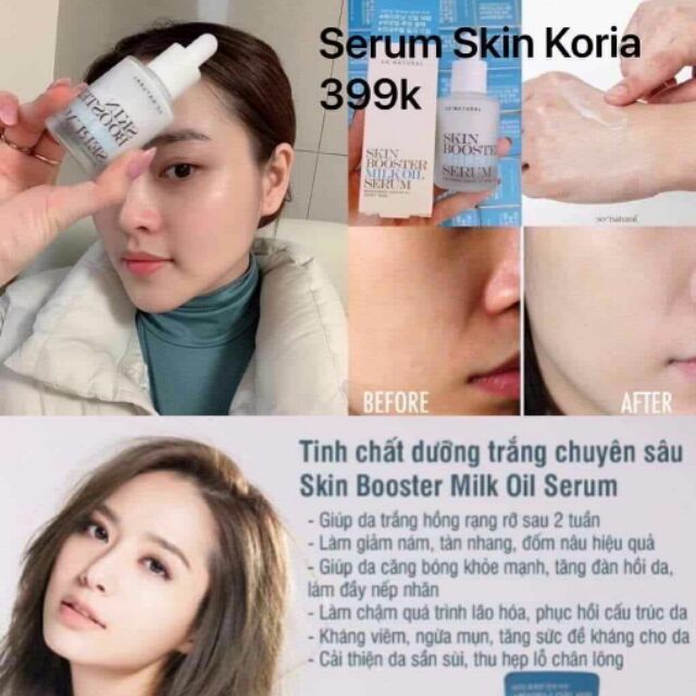 Serum skin koria