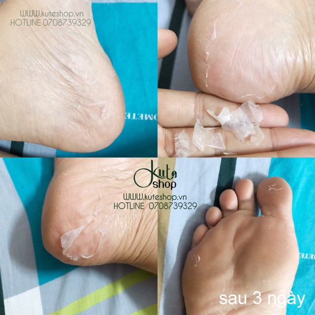 Túi Ủ Bong Da Chết Bàn Chân Mino Baby Foot Của Nhật