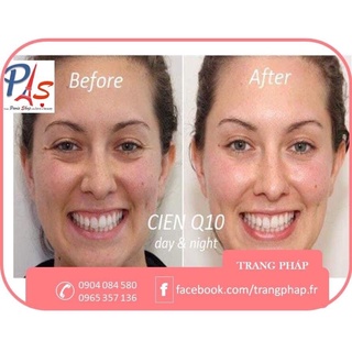 [AUTH PHÁP] Kem dưỡng Q10 CIEN