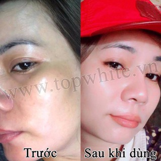 topwhite D1 mẫu mới 2020