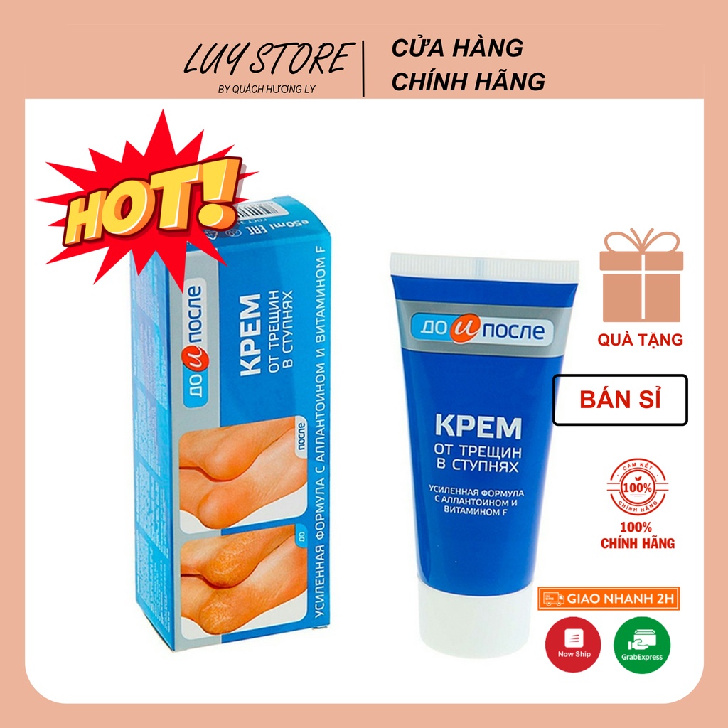 Kem Ngăn Ngừa Và Hồi Phục Nứt Nẻ Gót Chân Kpem Nga 50ml