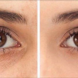 Kem giảm thâm mắt Kumargic