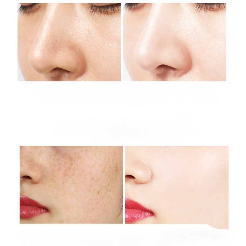 [Hàng mới về] Kem xóa khuyết điểm vết tàn nhang HIISEES chứa Niacinamide làm trắng dưỡng ẩm da