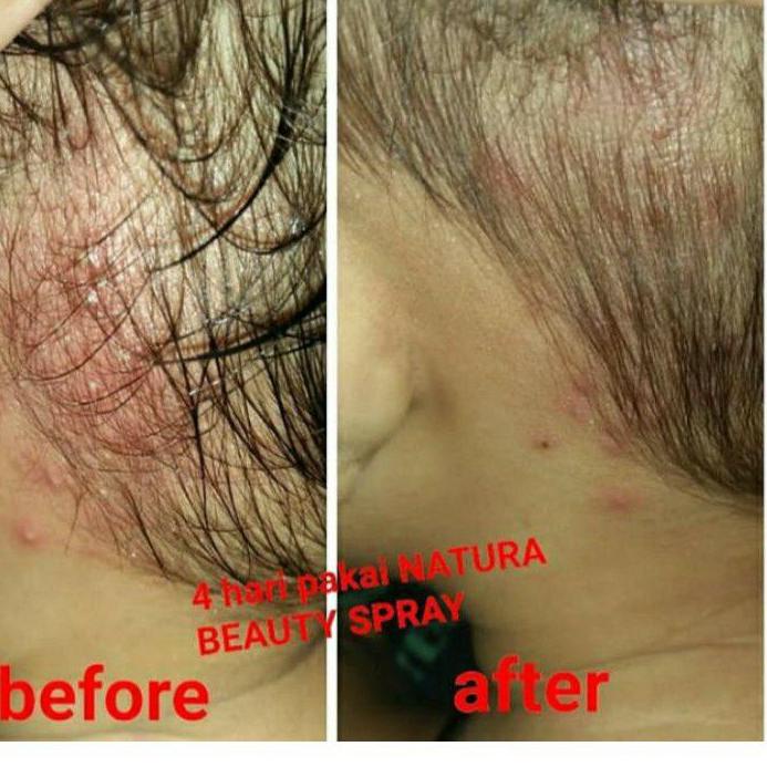 ! Tấm trải giường phun sương làm đẹp mã-288 Natura thế giới 10 | BigBuy360 - bigbuy360.vn