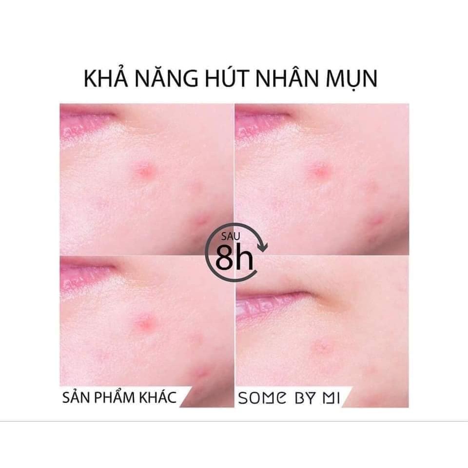 Combo 2 Miếng Dán Giảm Mụn Some By Mi Clear Spot Patch (Set 18 miếng) x 2