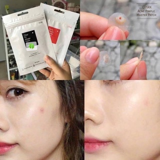 Miếng Dán Mụn Cosrx Acne Pimple Master Patch (Túi 18 - 24 miếng)