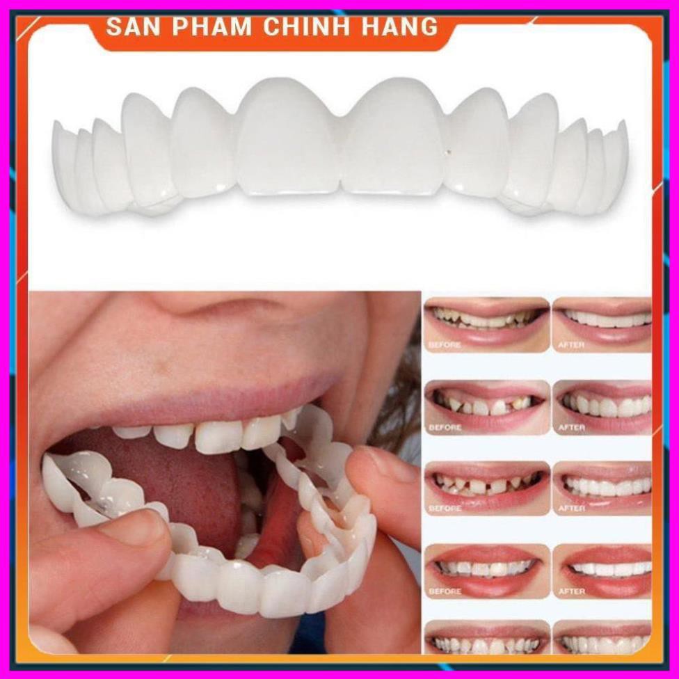 Dụng cụ niềng răng tại nhà snapon smile - nẹp răng tại nhà