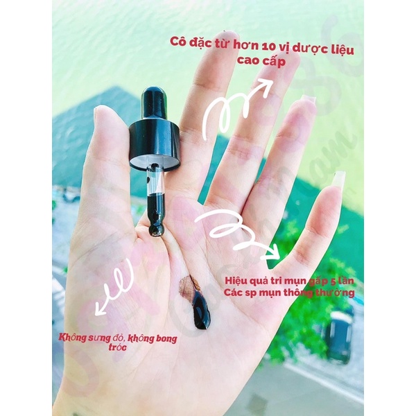 Cao lá nam dược liệu 5ML ( Cao mụn cô đặc ) giải quyết mụn từ nhẹ đến nặng