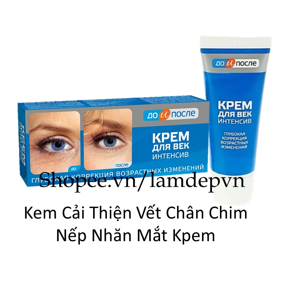 Kem Cải Thiện Vết Chân Chim  Nếp Nhăn Mắt Kpem Nga 30ml INTENSIVE