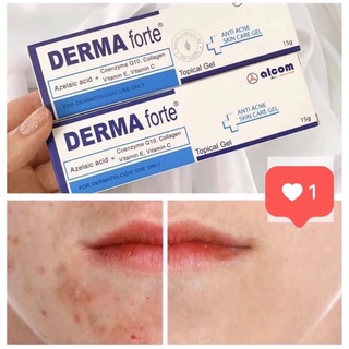 Kem chấm mụn Derma Forte 15g